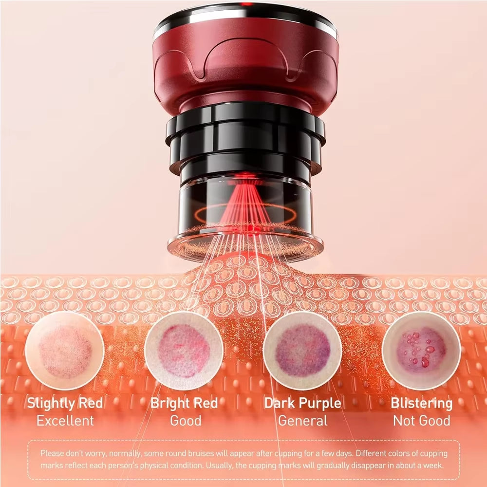 (8 cups) Vacuum Cupping Massager™